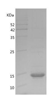    GSK3B / Recombinant Human GSK3B