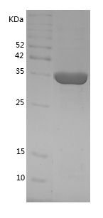    MKK6 / Recombinant Human MKK6