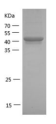    IRAK1 / Recombinant Human IRAK1