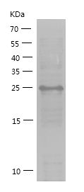    TRIAD3A / Recombinant Human TRIAD3A