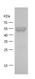    IKBα / Recombinant Human IKBα