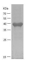    IKBβ / Recombinant Human IKBβ