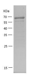    HDAC1 / Recombinant Human HDAC1