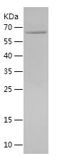    Vinculin / Recombinant Human Vinculin