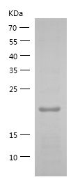    SHIP2 / Recombinant Human SHIP2