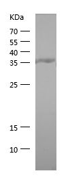    PTP1B / Recombinant Human PTP1B