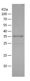    FOXO1 / Recombinant Human FOXO1