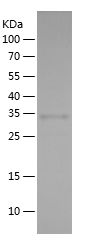    IRF7 / Recombinant Human IRF7