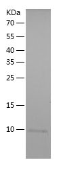    PRKCH / Recombinant Human PRKCH