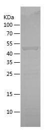    HSP27 / Recombinant Human HSP27