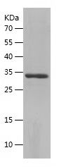    GDF3 / Recombinant Human GDF3