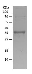    GDF5 / Recombinant Human GDF5