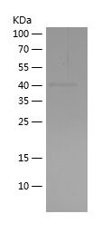    CYLD / Recombinant Human CYLD