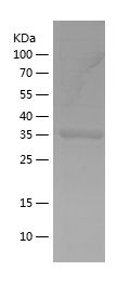    FYN / Recombinant Human FYN