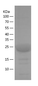    PPP2R2A / Recombinant Human PPP2R2A