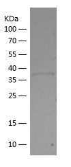    GS / Recombinant Human GS