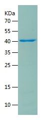    HDAC2 / Recombinant Human HDAC2