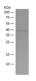    IKBKB / Recombinant Human IKBKB