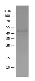    PIAS4 / Recombinant Human PIAS4