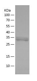    PP1B / Recombinant Human PP1B