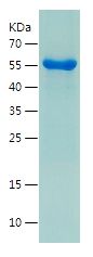    HDAC1 / Recombinant Human HDAC1