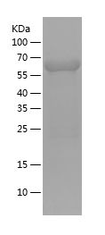    IKBKG / Recombinant Human IKBKG