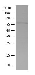    PP1G / Recombinant Human PP1G