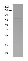    PP1G / Recombinant Human PP1G