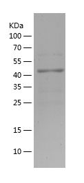    PCAF / Recombinant Human PCAF