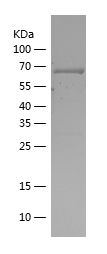    CK2A1 / Recombinant Human CK2A1