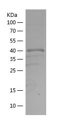    LKB1 / Recombinant Human LKB1