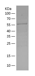    PRKAB2 / Recombinant Human PRKAB2