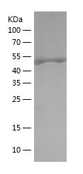    PDPK1 / Recombinant Human PDPK1