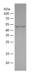    PRKAA2 / Recombinant Human PRKAA2