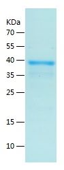    SIK2 / Recombinant Human SIK2