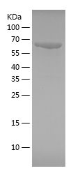    HSPA1A / Recombinant Human HSPA1A