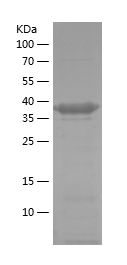    PFKP / Recombinant Human PFKP