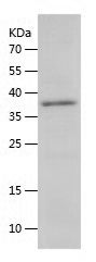    PRAS40 / Recombinant Human PRAS40