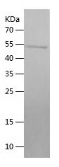    P53 / Recombinant Human P53