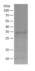    ADO / Recombinant Human ADO