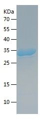    ACC1 / Recombinant Human ACC1