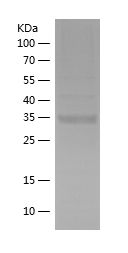    HK3 / Recombinant Human HK3