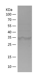    IDH1 / Recombinant Human IDH1