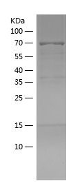    EHBP1 / Recombinant Human EHBP1