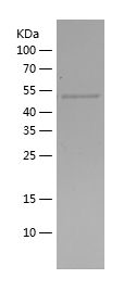    SOCS3 / Recombinant Human SOCS3