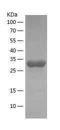    PDK1 / Recombinant Human PDK1