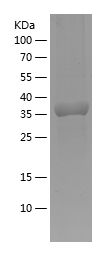    CAV1 / Recombinant Human CAV1