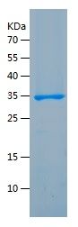    Irisin / Recombinant Human Irisin