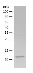    Rantes / Recombinant Human Rantes