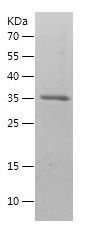    BDNF / Recombinant Human BDNF